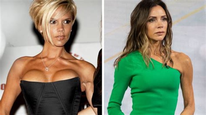 ‘Bachelor’s Amanda Stanton Gets Huge Breast Implants & Shows Them Off In Before & After Pics