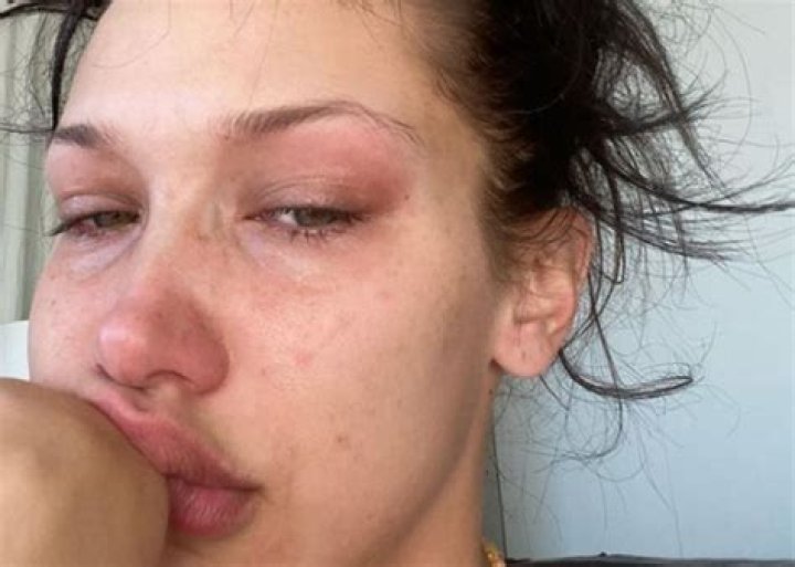 Bella Hadid Opens Up About Mental Health With Crying Selfies – Hollywood Life