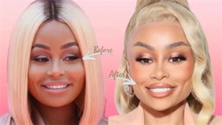 Blac Chyna Debuts New Buzzed Head Hair Makeover In Video: Before & After