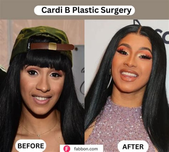 Cardi B Suffers Plastic Surgery Complications & Cancels Show: Report – Hollywood Life