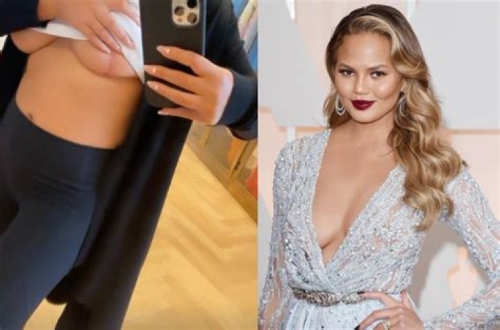 Chrissy Teigen Reveals She Has Breast Implants — But Wants ‘Them Out Now’