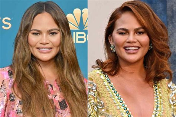 Chrissy Teigen Breaks Silence On Michael Costello DM Allegations: I’m ‘Disappointed’ By ‘His Attack’