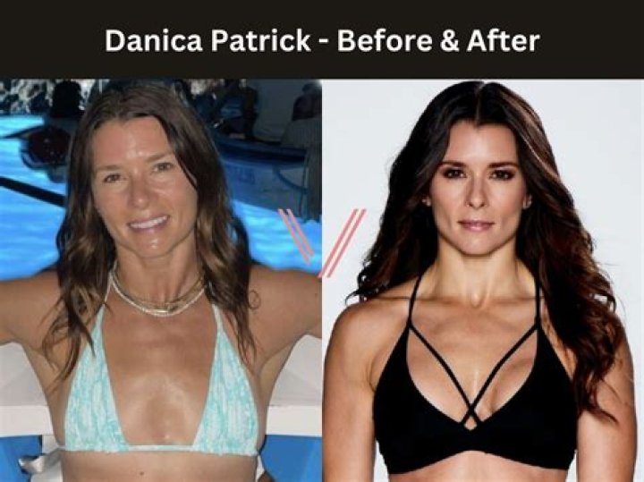 Before & After Face Photos – Hollywood Life