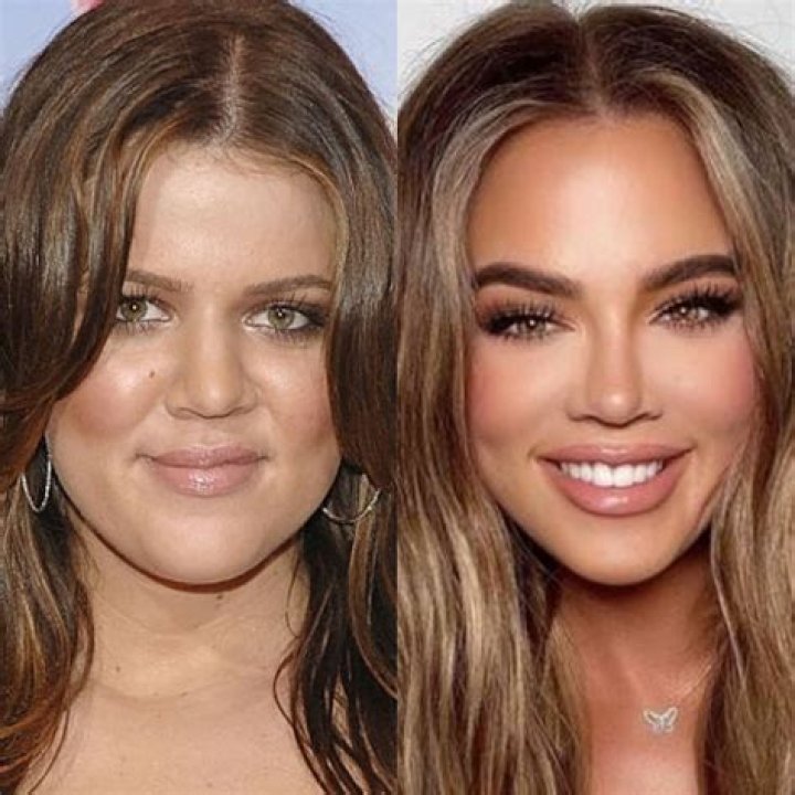 Khloe Kardashian: Plastic Surgeon Speaks On Appearance After Fans Think She Had A Nose Job