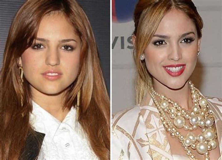 [PICS] Eiza Gonzalez’s Plastic Surgery — She’s Had More Than Nose Job – Hollywood Life