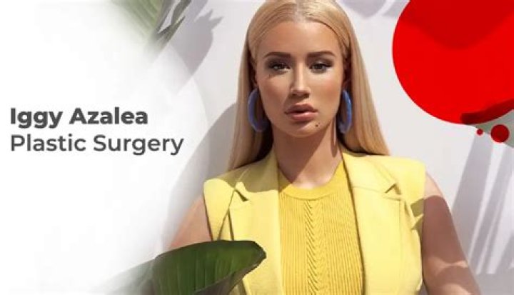 Iggy Azalea’s Plastic Surgery Noticeable In Artwork For New Single – Hollywood Life