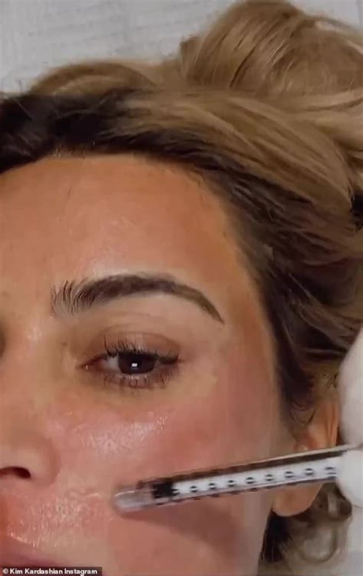 Kim Kardashian Admits To Laser Treatments To ‘Erase Wrinkles’ – Hollywood Life