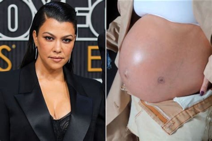 Kourtney Kardashian Reveals Son Rocky Had ‘Fluid in His Lungs’ Before Fetal Surgery