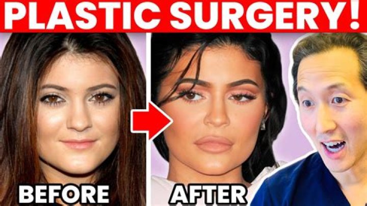 Kylie Jenner Plastic Surgery Reason — Why She Had 6 Procedures Done – Hollywood Life