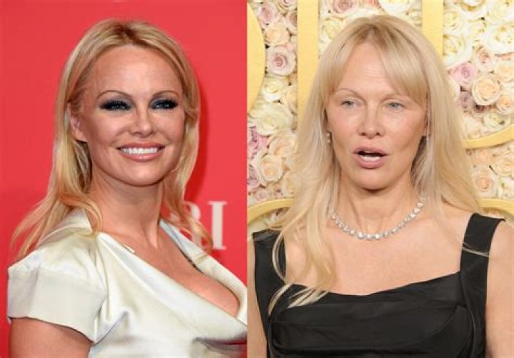 Pamela Anderson Goes For Make-Up Free Walk With Dog Before ‘Pam & Tommy’ Premiere – Photos