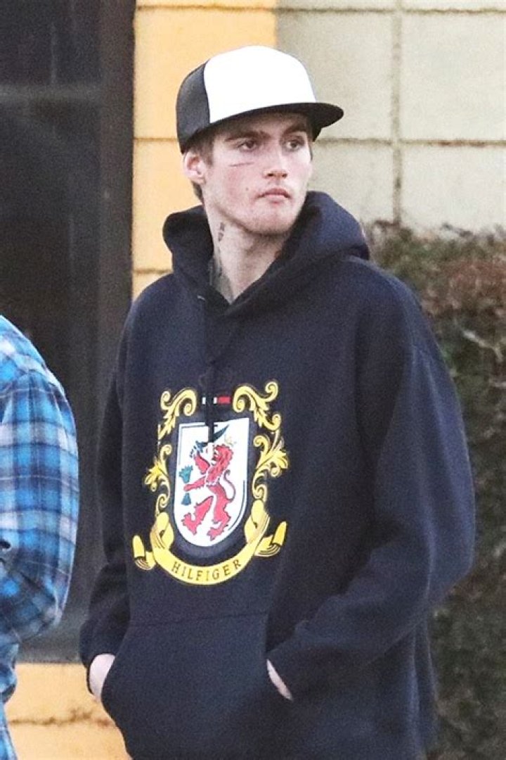 Presley Gerber Seemingly Has ‘Misunderstood’ Face Tattoo Removed – Hollywood Life