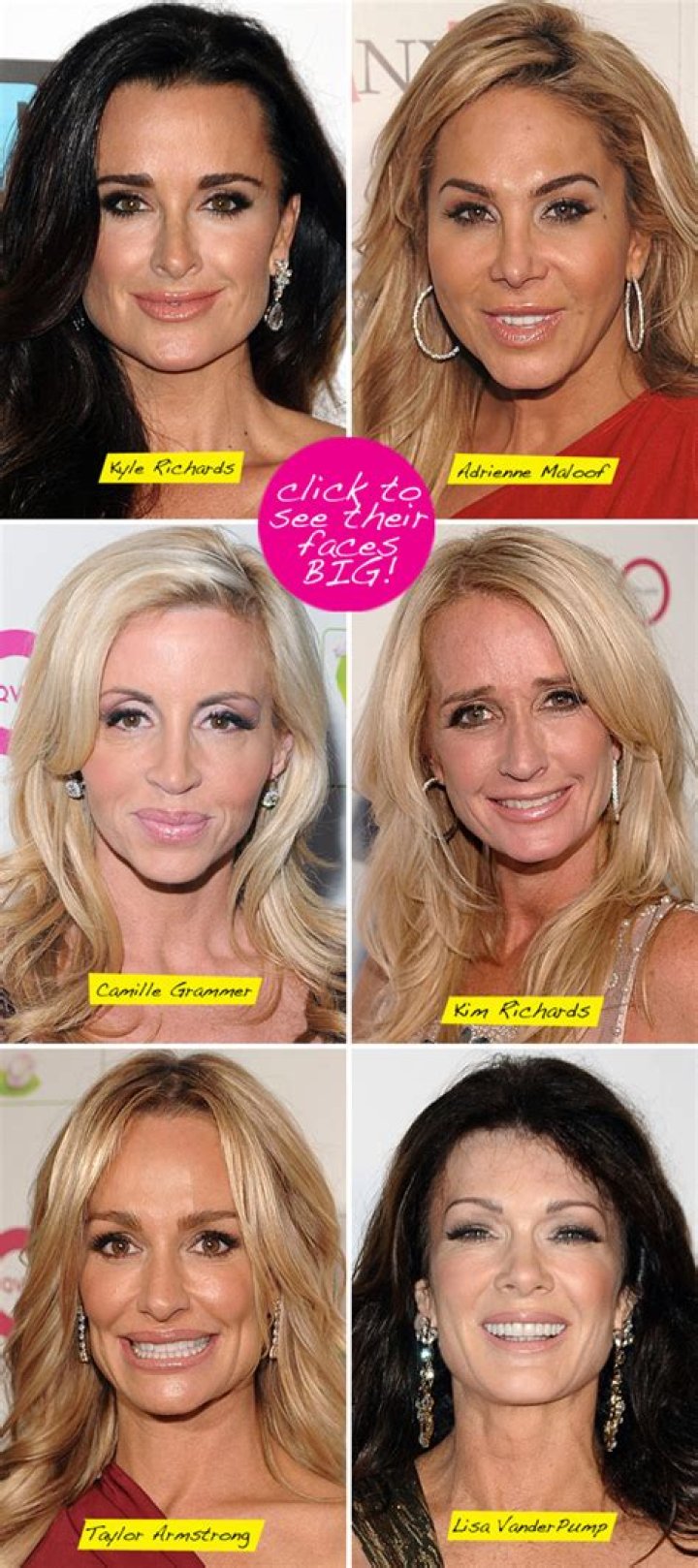 Botox, Implants & More! – Hollywood Life