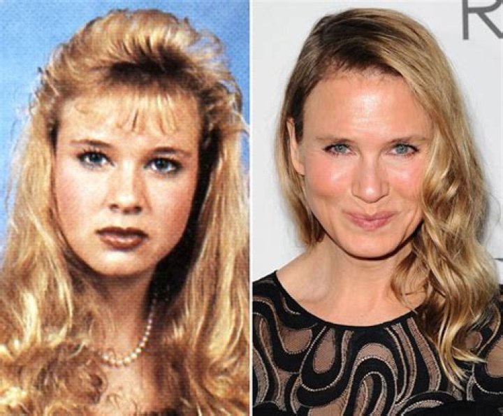 Renee Zellweger Before Plastic Surgery — What Her Face Looked Like In High School – Hollywood Life