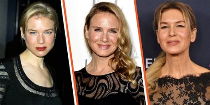 Renee Zellweger Speaks Out About Her Plastic Surgery In New Interview