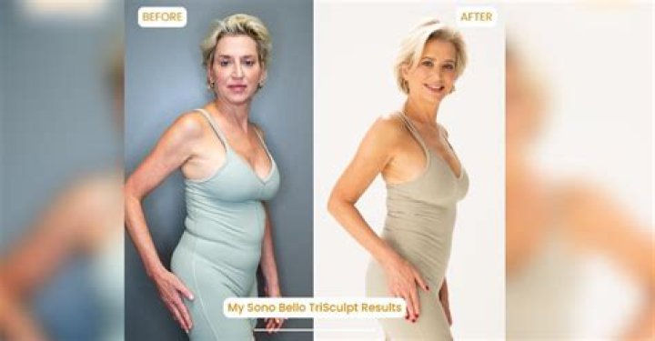 ‘RHONY’s Dorinda Medley, 56, Drops 11 Lbs. & 7 Inches After Quarantine Weight Gain — Watch