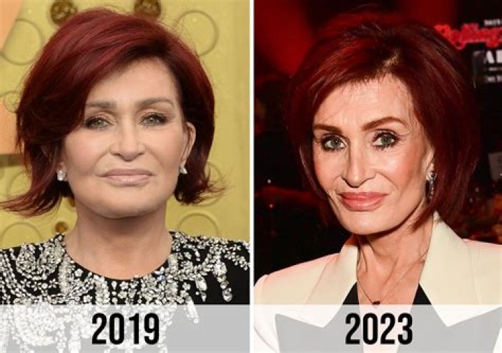 Sharon Osbourne, 67, Reveals The Agonizing Pain She Was In After Her 4th Facelift: ‘Help Me’