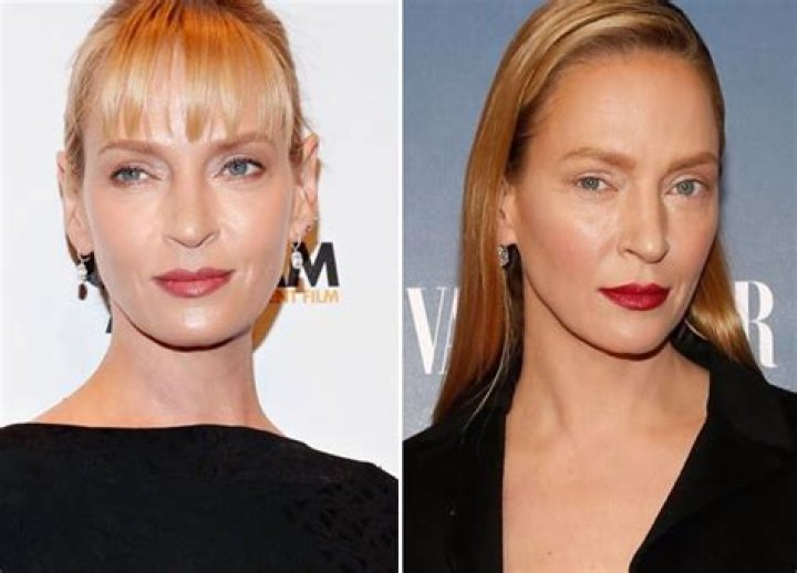 Plastic Surgery? — See Before & After Photos – Hollywood Life