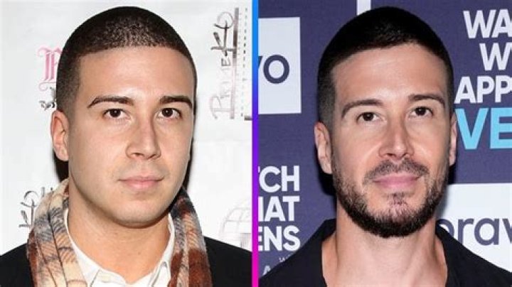 Vinny Guadagnino News, Photos and Videos – Hollywood Life