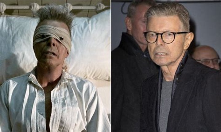 What Is Liver Cancer? 5 Things To Know About David Bowie’s Fatal Illness – Hollywood Life