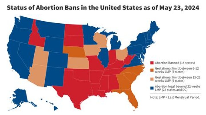 Louisiana: 5 Facts About Strict Law Banning Abortion With No Exceptions For Rape & Incest