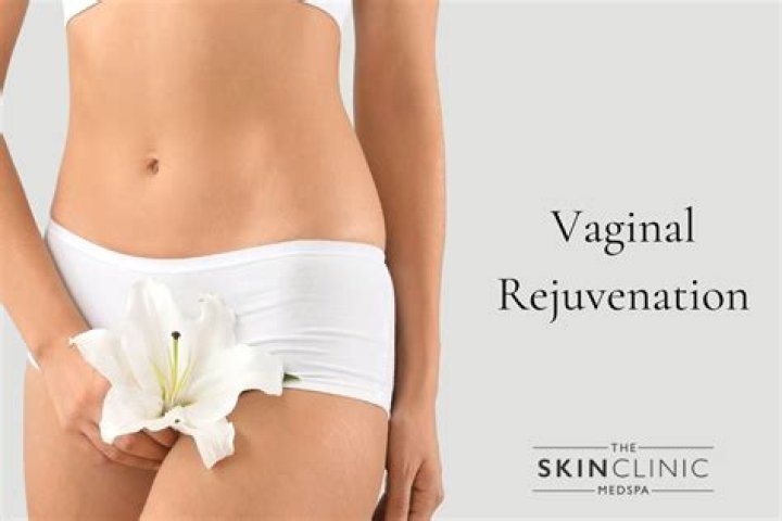 Vaginal Rejuvenation: 5 Things To Know About The Procedure That Jeremy Meeks’ Estranged Wife Had